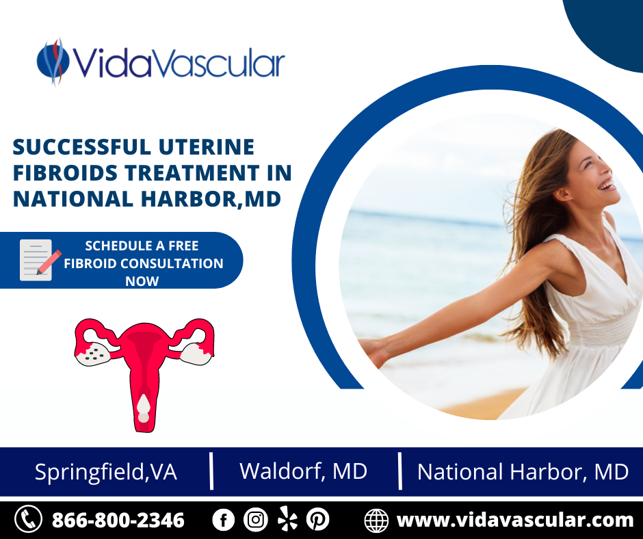 Successful Uterine Fibroids Treatment In National Harbor Md Vidavascular