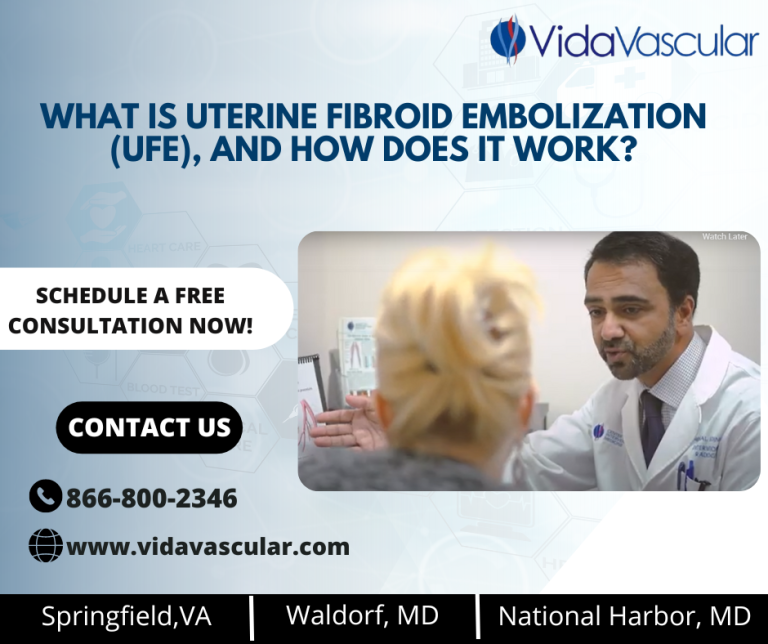 What Is Uterine Fibroid Embolization Ufe And How Does It Work Vidavascular 