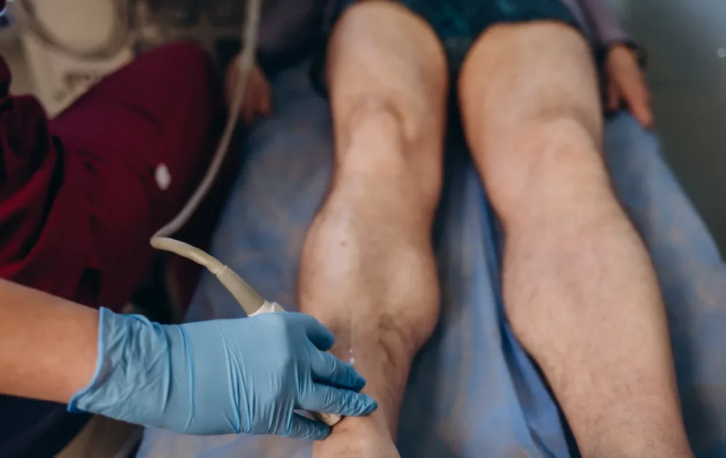 Patient lower legs positioned for a leg vein ultrasound exam